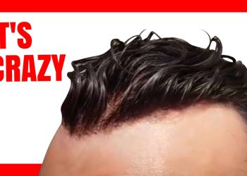 undetectable hair system